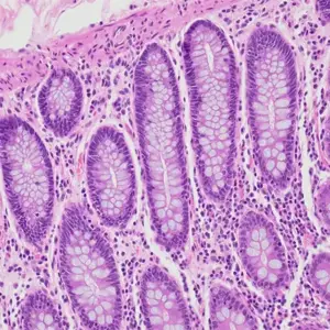 microscoop schoonmaken om beeldverlies te voorkomen