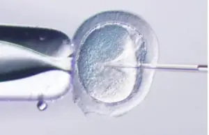 microscoop verlichting